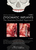 ZYGOMATIC IMPLANTS { The Anatomy|Guided Approach